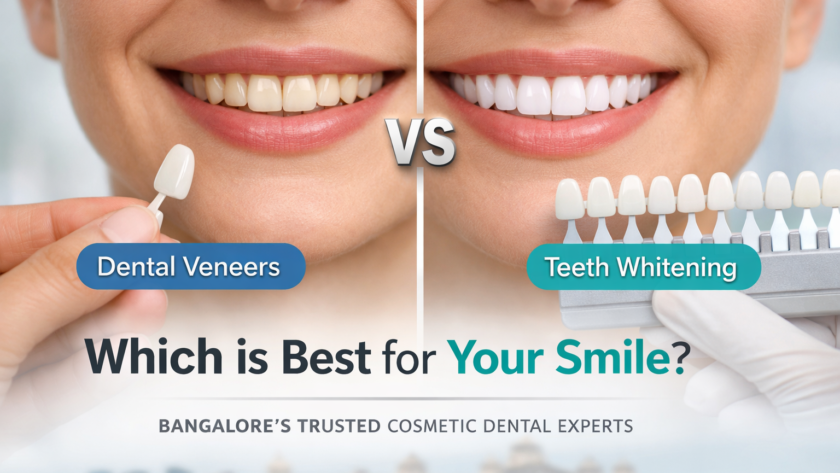 dental clinic Bangalore