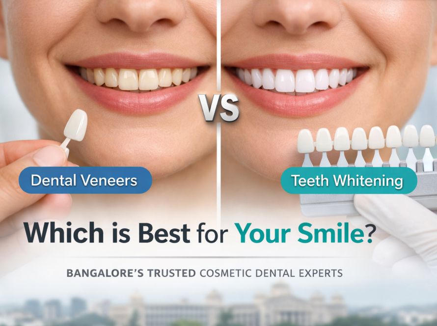dental clinic Bangalore