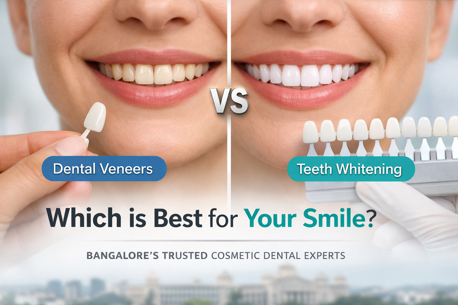 dental clinic Bangalore