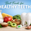 Best Foods for Healthy Teeth | Dentist Tips