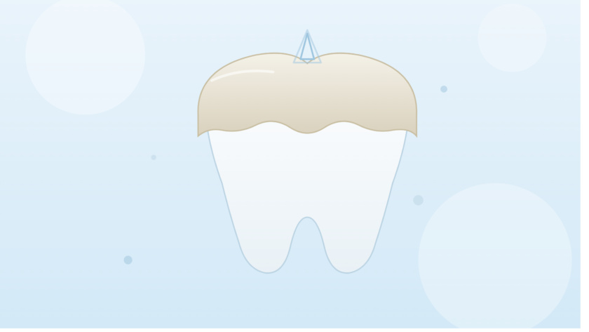 dental crown explained