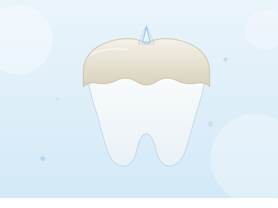 dental crown explained