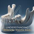 Why Do Wisdom Teeth Cause Pain? 4 Real Reasons They Hurt